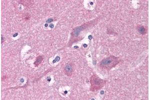 Human Brain, Cortex: Formalin-Fixed, Paraffin-Embedded (FFPE) (PAK1 antibody  (AA 245-490))