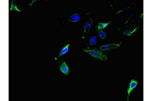 Immunofluorescent analysis of Hela cells using ABIN7143907 at dilution of 1:100 and Alexa Fluor 488-congugated AffiniPure Goat Anti-Rabbit IgG(H+L) (AMACR antibody  (AA 13-175))