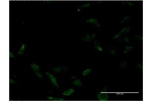 Immunofluorescence of monoclonal antibody to MUTYH on HeLa cell. (MUTYH antibody  (AA 436-535))