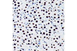 Immunohistochemistry of paraffin-embedded rat ovary using TDP-43/TARDB Rabbit mAb (ABIN7270730) at dilution of 1:100 (40x lens). (TARDBP antibody)