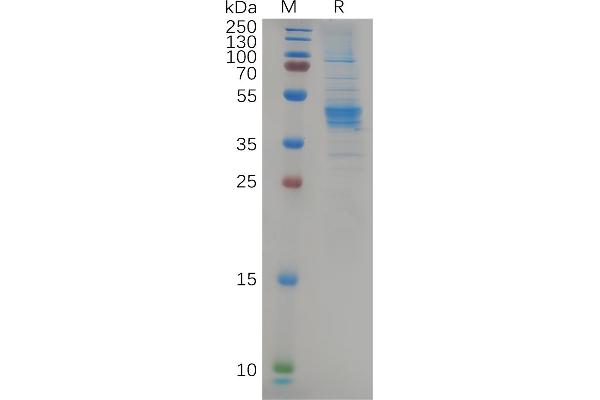 CCR6 Protein (AA 1-47) (Fc Tag)