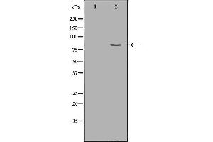 Western blot analysis of Hepg2 whole cell lysates, using PRPF3 Antibody. (PRPF3 antibody  (N-Term))