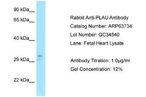 Western Blotting (WB) image for anti-Plasminogen Activator, Urokinase (PLAU) (C-Term) antibody (ABIN971412) (PLAU antibody  (C-Term))