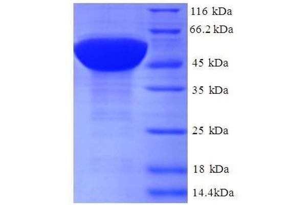 RPL17 Protein (AA 2-184, full length) (GST tag)