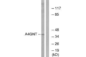 Western blot analysis of extracts from K562 cells, using A4GNT antibody. (A4GNT antibody)