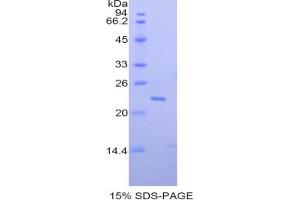 SDS-PAGE analysis of Mouse Paraoxonase 1 Protein. (PON1 Protein)