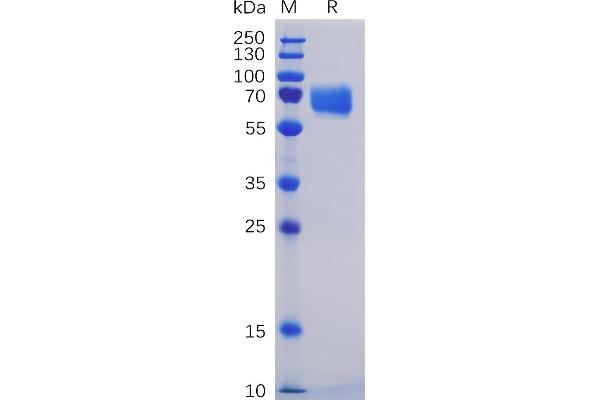 CD84 Protein (CD84) (AA 22-225) (mFc-His Tag)