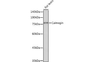 Western blot analysis of extracts of Rat testis, using Calmegin Rabbit mAb (ABIN7266025) at 1:1000 dilution. (Calmegin antibody)