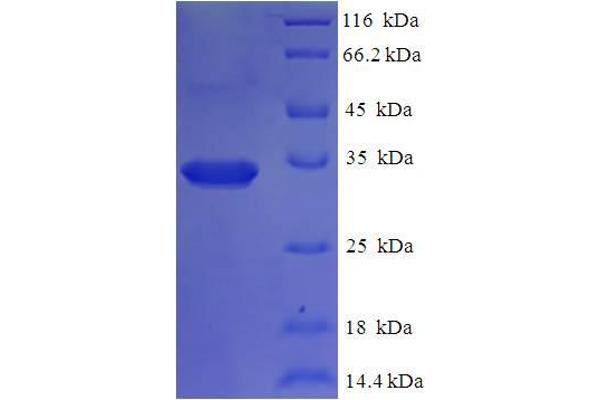 KIF1C Protein (AA 1-272) (His tag)