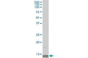 JTB polyclonal antibody (A01), Lot # NBI0061124QCS1 Western Blot analysis of JTB expression in IMR-32 . (JTB antibody  (AA 1-146))