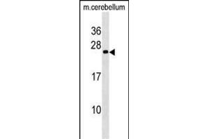 Mouse BAD Antibody (Center //) (ABIN6243058 and ABIN6577363) western blot analysis in mouse cerebellum tissue lysates (35 μg/lane). (BAD antibody  (AA 90-118))