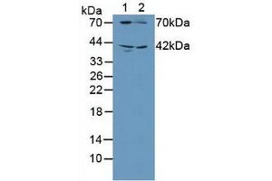 Western blot analysis of (1) Human Blood Platelet Cells and (2) Rat Brain Tissue. (GUCY1B3 antibody  (AA 408-619))