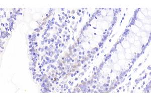 Detection of CDX2 in Human Colon Tissue using Polyclonal Antibody to Caudal Type Homeobox 2 (CDX2) (CDX2 antibody  (AA 1-313))