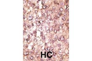 Immunohistochemistry (Paraffin-embedded Sections) (IHC (p)) image for anti-ATG5 Autophagy Related 5 (ATG5) (AA 209-238), (C-Term) antibody (ABIN388519)