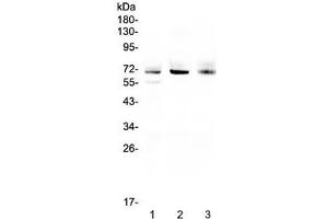 Western blot testing of human 1) A549, 2) SGC-7901 and 3) U-2 OS cell lysate with Bestrophin 1 antibody at 0. (Bestrophin 1 antibody)