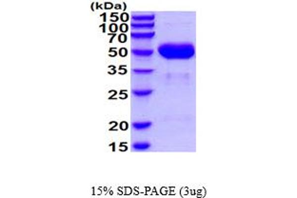 CTSA Protein (AA 24-474) (His tag)