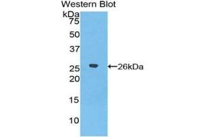 Detection of Recombinant TFR2, Human using Polyclonal Antibody to Transferrin Receptor 2 (TFR2) (Transferrin Receptor 2 antibody  (AA 211-405))