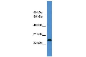 WB Suggested Anti-CD27 Antibody Titration: 0. (CD27 antibody  (C-Term))