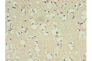 Immunohistochemistry of paraffin-embedded human brain tissue using ABIN7145721 at dilution of 1:100 (BDNF antibody  (AA 129-247))