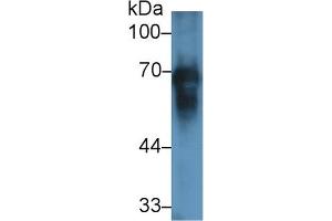 Detection of ALB in Equine Plasma using Polyclonal Antibody to Albumin (ALB) (Albumin antibody)