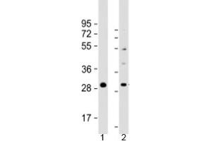 Western blot testing of human 1) RPMI 8226 and 2) SH-SY5Y cell lysate with PPAPDC1B antibody at 1:2000. (PPAPDC1B antibody  (AA 114-146))