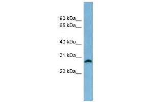 SRD5A2 antibody used at 1 ug/ml to detect target protein. (SRD5A2 antibody)