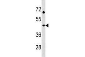 LAMP3 antibody western blot analysis in Jurkat lysate. (LAMP3 antibody  (AA 8-38))