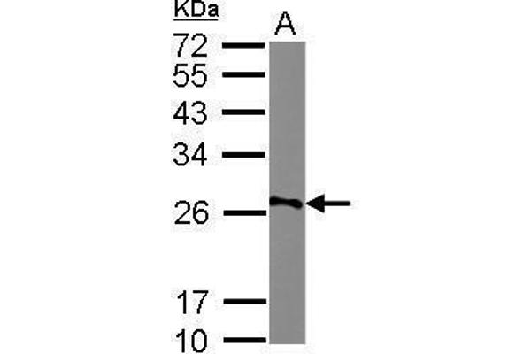 AGPAT1 antibody  (Center)