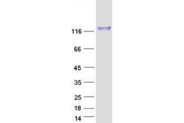 USP28 Protein (Myc-DYKDDDDK Tag)