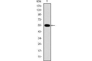 Western Blotting (WB) image for anti-Interleukin-1 Receptor-Associated Kinase 4 (IRAK4) antibody (ABIN969218)