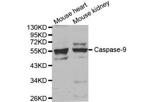 Western blot analysis of extracts of mouse heart and kidney tissue, using CASP9 antibody. (Caspase 9 antibody)