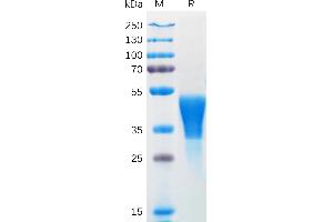 Human M-CSF Protein, His Tag on SDS-PAGE under reducing condition. (M-CSF/CSF1 Protein (AA 33-255) (His tag))