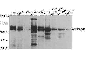 Western blot analysis of extracts of various cell lines, using ANKRD52 antibody (ABIN5974842) at 1/1000 dilution. (ANKRD52 antibody)