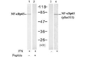 Image no. 2 for anti-Nuclear Factor-kB p65 (NFkBP65) (Ser311) antibody (ABIN197510) (NF-kB p65 antibody  (Ser311))
