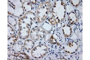 Immunohistochemistry (IHC) image for anti-Lipase, Endothelial (LIPG) antibody (ABIN1499170) (LIPG antibody)