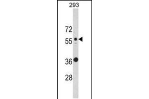 Western blot analysis of KRT10 Antibody in 293 cell line lysates (35ug/lane) (Keratin 10 antibody  (N-Term))