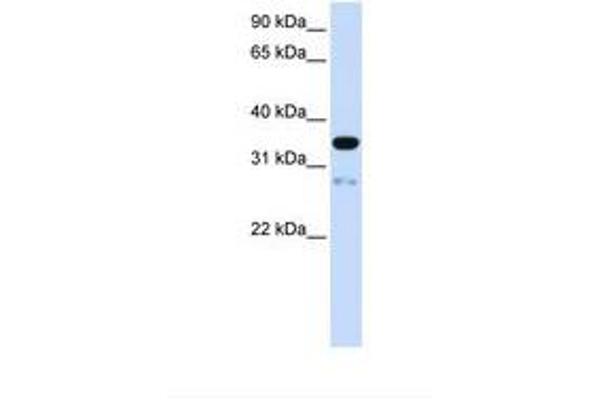 TMEM38A antibody  (AA 74-123)