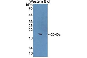 Western blot analysis of the recombinant protein. (IL-22 antibody  (AA 34-179))