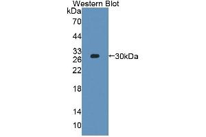 Detection of Recombinant PLCh2, Human using Polyclonal Antibody to Phospholipase C Eta 2 (PLCh2) (PLCH2 antibody  (AA 1-257))