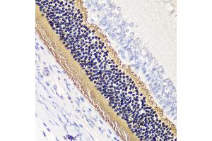 Immunohistochemistry of paraffin-embedded rat retina using PDC antibody (ABIN7269269) at dilution of 1:200 (40x lens). (Phosducin antibody  (AA 1-246))