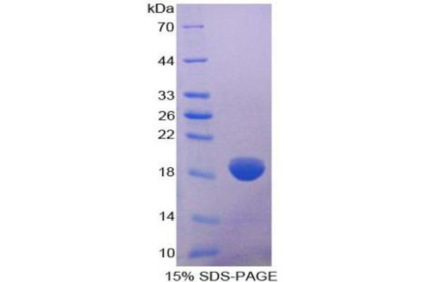 COL8a2 Protein