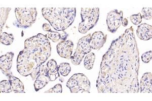 Detection of INSR in Human Placenta Tissue using Monoclonal Antibody to Insulin Receptor (INSR) (Insulin Receptor antibody)