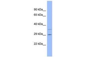 Image no. 1 for anti-Coagulation Factor XII (F12) (N-Term) antibody (ABIN6741747) (F12 antibody  (N-Term))