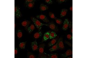 Immunofluorescence Analysis of A549 cells labeling MVP with MVP Monoclonal Antibody (Clone 1014) followed by Goat anti-Mouse IgG-CF488 (Green). (MVP antibody)