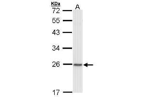 WB Image Sample (30 ug of whole cell lysate) A: Raji 12% SDS PAGE antibody diluted at 1:1000 (CBX1 antibody  (Center))