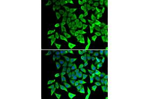 Immunofluorescence analysis of A549 cells using PTGES2 antibody (ABIN6291190). (PTGES2 antibody)