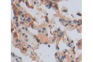 IHC-P analysis of lung tissue, with DAB staining. (DDC antibody  (AA 200-420))