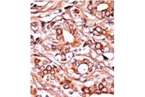 Image no. 2 for anti-C-Abl Oncogene 1, Non-Receptor tyrosine Kinase (ABL1) (pTyr134) antibody (ABIN358067) (ABL1 antibody  (pTyr134))