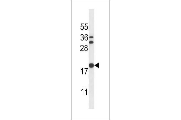 Stathmin 3 antibody  (C-Term)