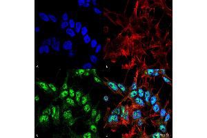 Immunocytochemistry/Immunofluorescence analysis using Rabbit Anti-Beclin 1 Polyclonal Antibody . (Beclin 1 antibody  (Biotin))
